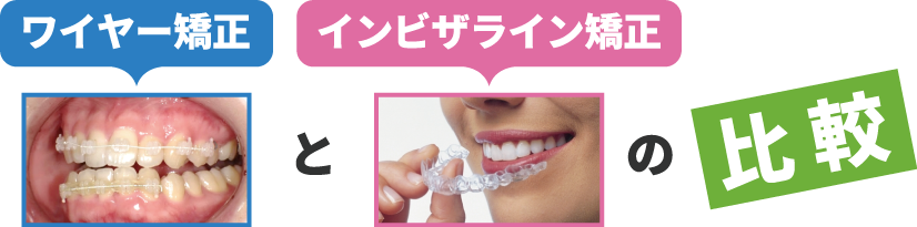 ワイヤー矯正とインビザライン矯正の違い